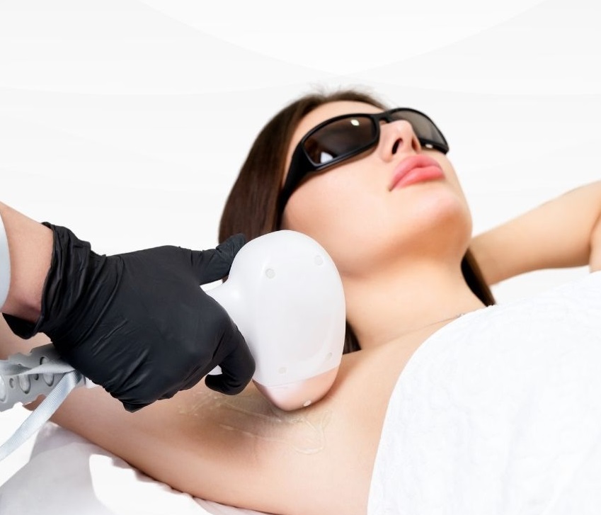 Laser Hair Removal